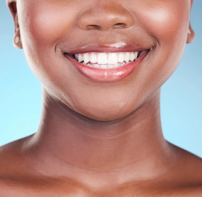 Bright smile after dental whitening