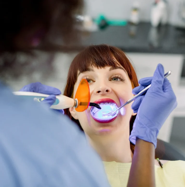 Dental sealant curing procedure