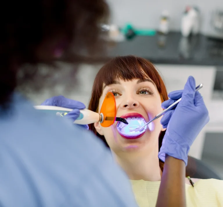 Dental sealant curing procedure