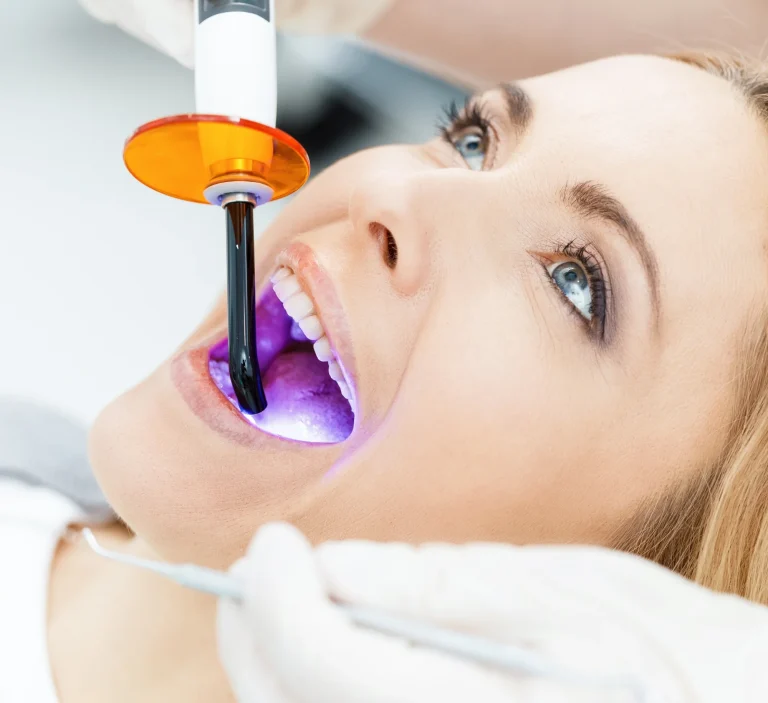 Dental sealant curing light