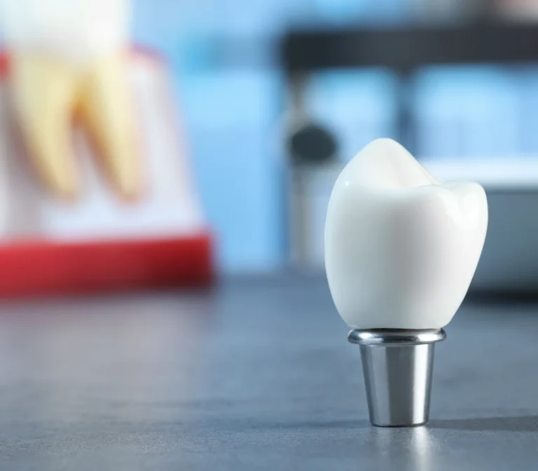 Single tooth restoration option