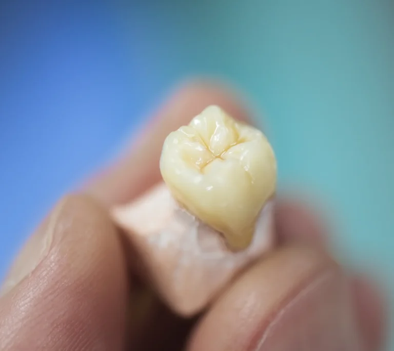 Ceramic dental crown close-up
