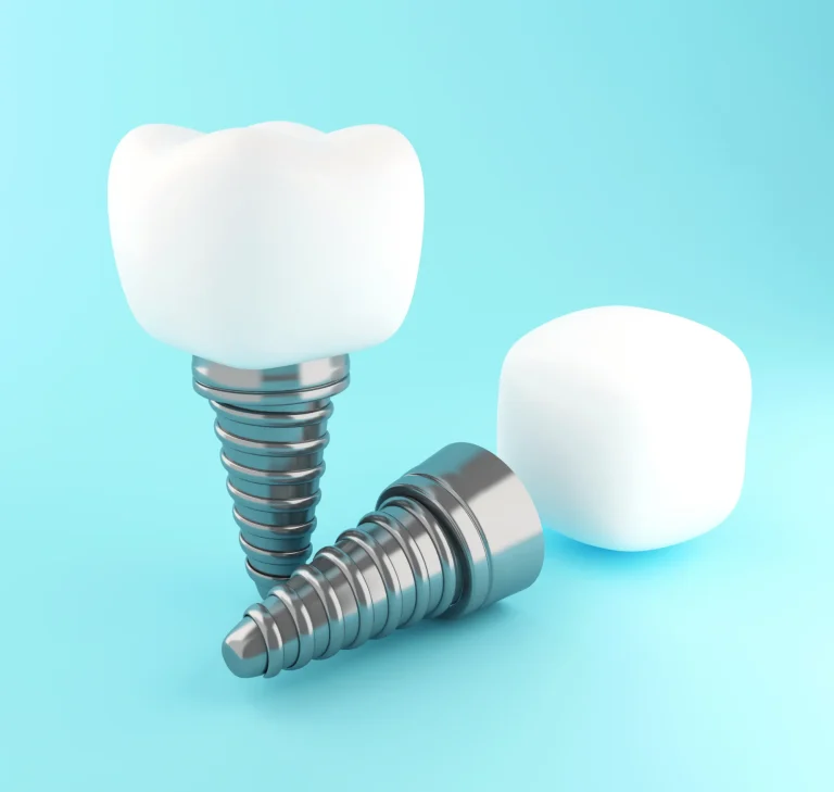 Implant supported tooth replacements