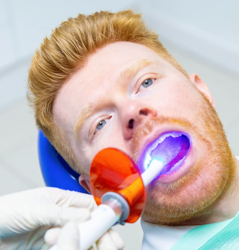 Professional fluoride dental procedure