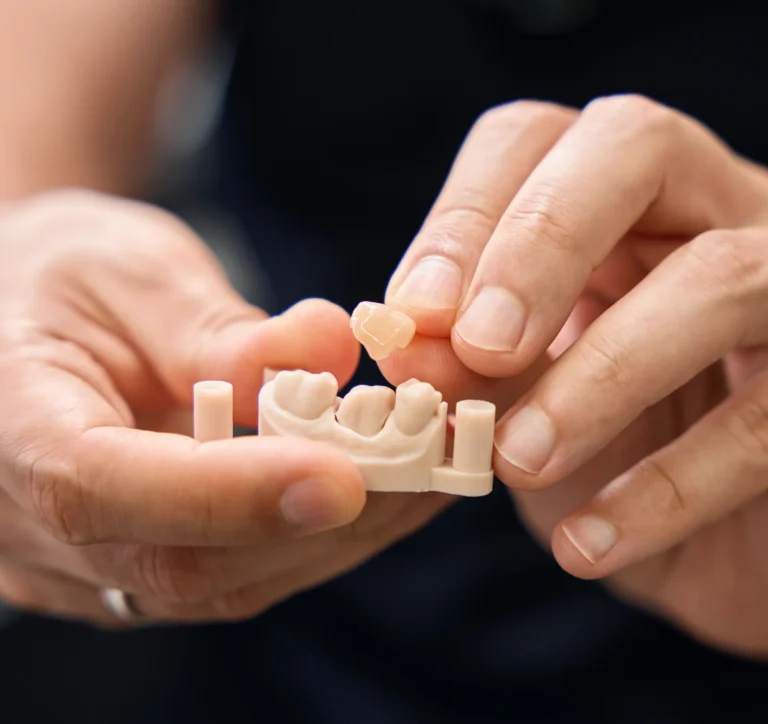 Creating custom dental restoration