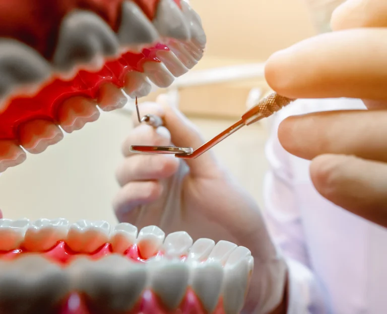 Gum disease examination model