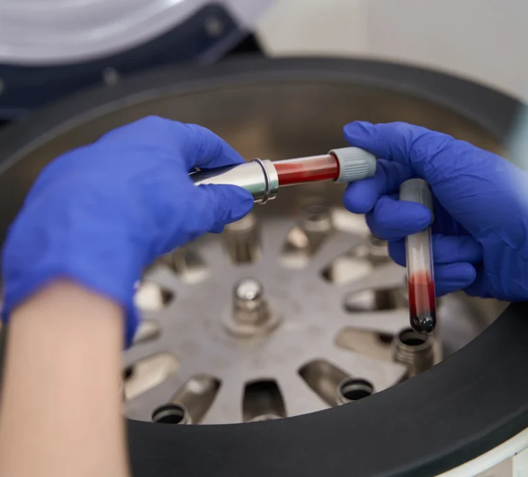 PRF centrifuge sample preparation