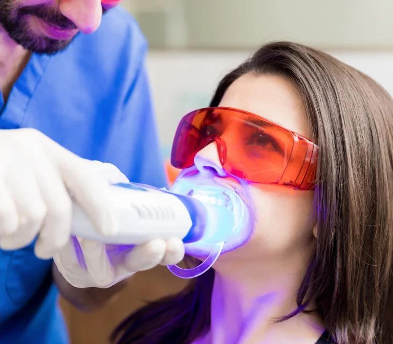 Fluoride treatment for teeth